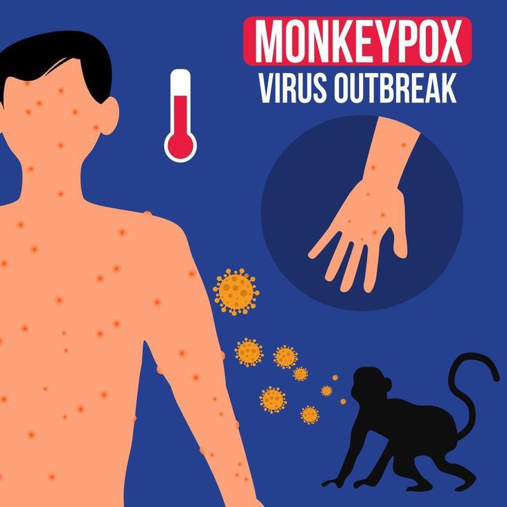 Monkeypox